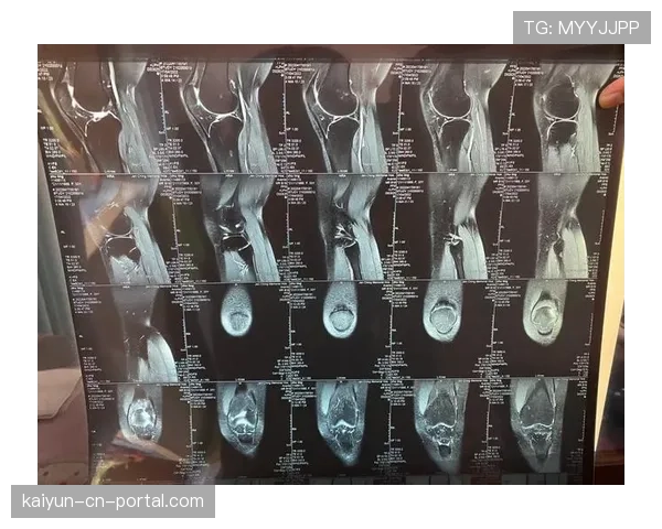 凯肖恩乔治左膝疼痛出战存疑 奇才后场年轻核心状态待评估